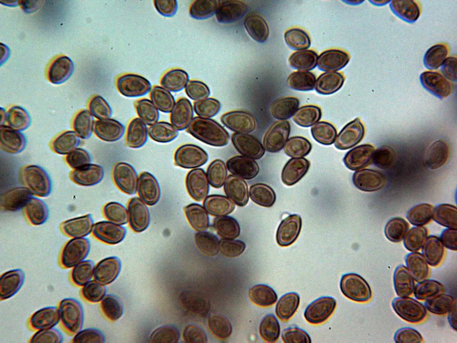 Microscopía de Leucoagaricus leucothites - 10 - Esporas Melzer 2